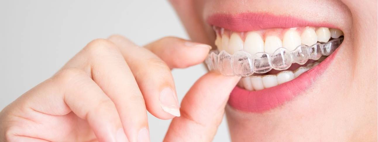 Dental Orthodontic Treatment