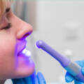 Full Mouth Rehabilitation