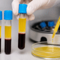 PRP Treatment: The Natural Way to Rejuvenate Skin and Restore Hair in India | A Complete Guide for International Patients